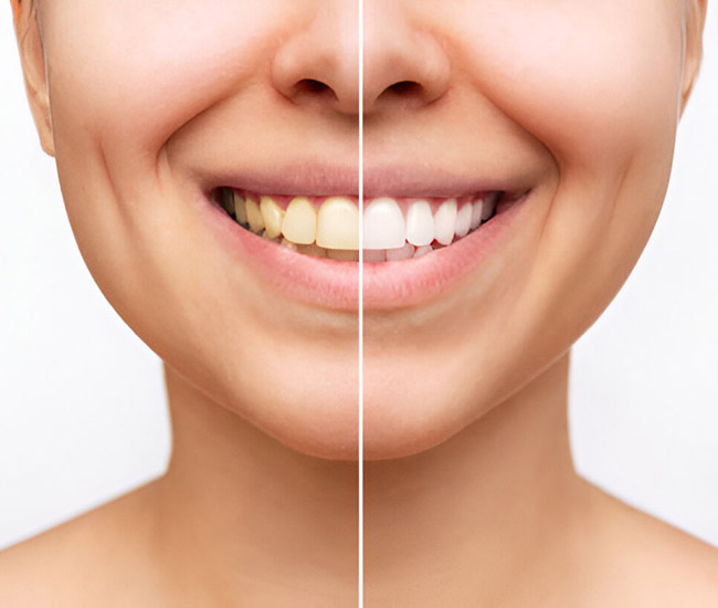 The Best Natural Ways to Whiten Your Teeth The Best Natural Ways to Whiten Your Teeth