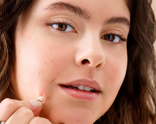 Pimple Patches for Clear Skin and the Best Ones to Try 